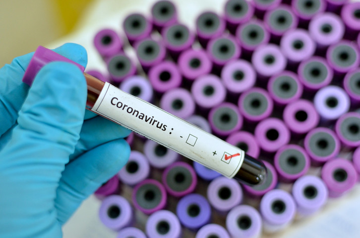 Ghana has now confirmed nine cases of coronavirus in the country